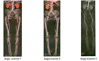 angio-scanner123-francisci